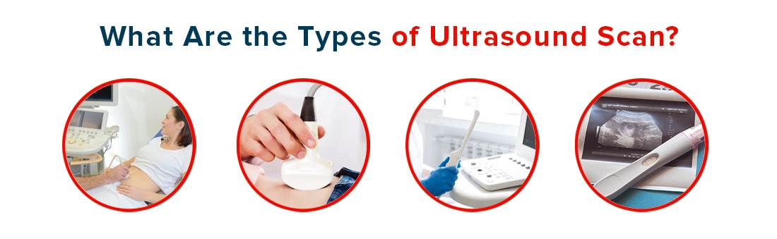 Types of Ultrasound Scan